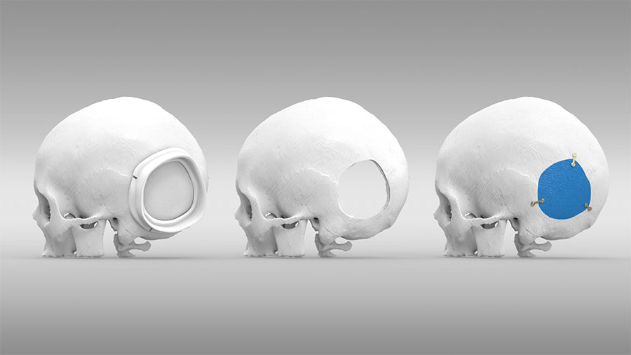 Conjunto_cranios